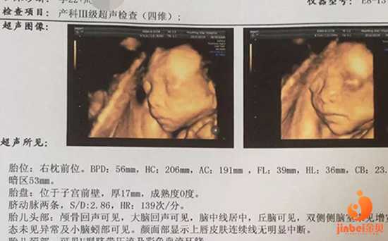 昆明哪家做代孕好,国内可以做试管婴儿吗？-上海哪有可以做供卵试管_专家分析